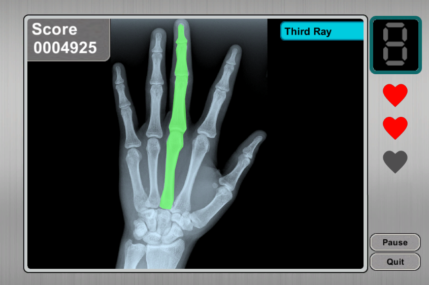 X-Ray Hand Challenge Game Screenshot